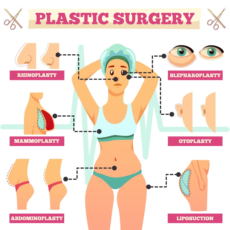 Vecteur gratuit organigramme orthogonal de chirurgie plastique