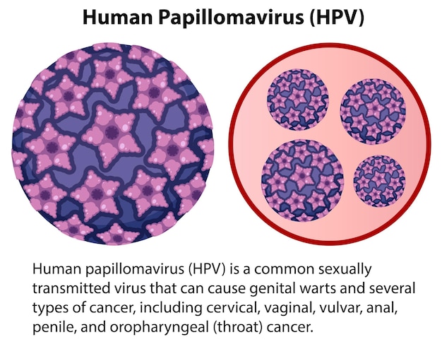 Vecteur gratuit papillomavirus humain avec explication