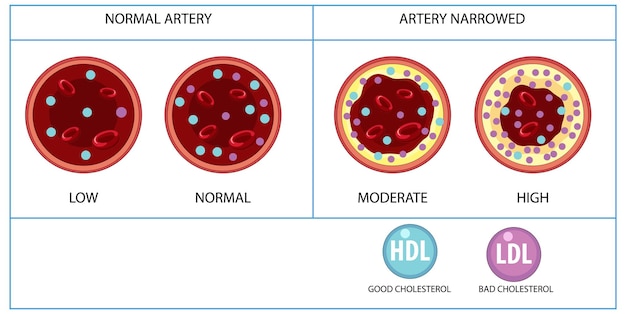 Vecteur gratuit types de cholestérol hdl et ldl