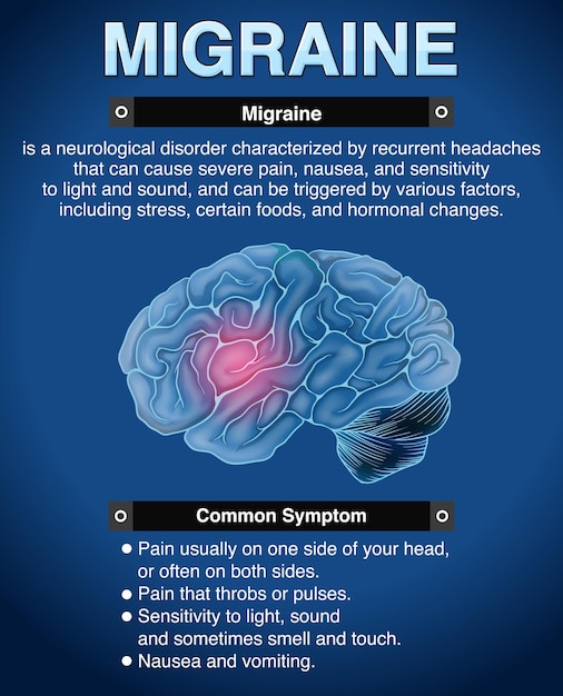 Vecteur affiche informative de migraine