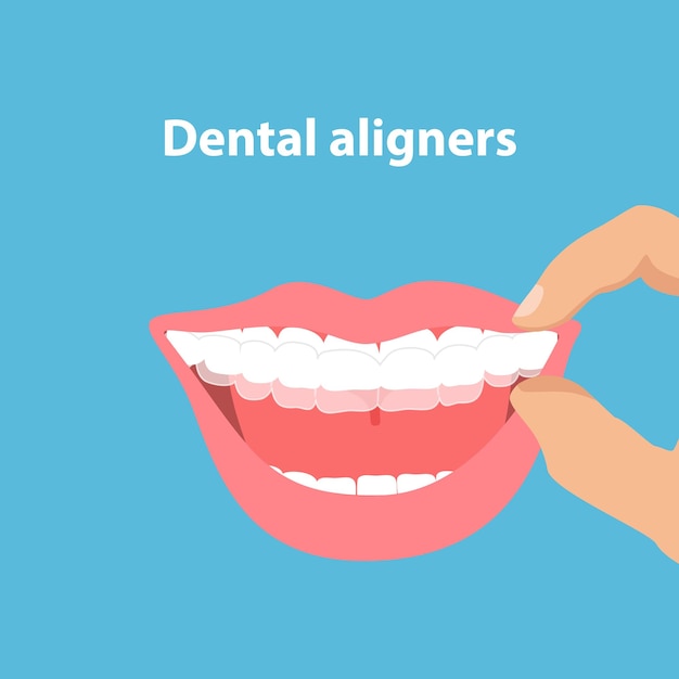 Alignement des dents par des aligners Concept d'orthodontie dentaire