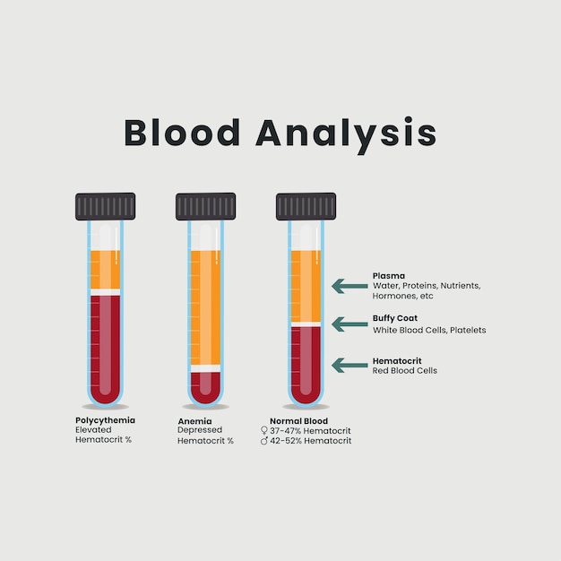Analyse De Sang Dans Le Vecteur De Tubes à Essai