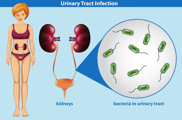 Anatomie Humaine De L'infection Des Voies Urinaires