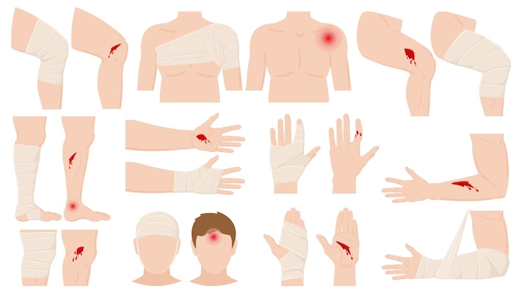 Vecteur blessure physique de dessin animé, application de bandage de plaie. parties du corps ouvertes et bandées, plaies traitées, illustration vectorielle de fractures. traitement des blessures corporelles humaines. blessure et blessure accident physique