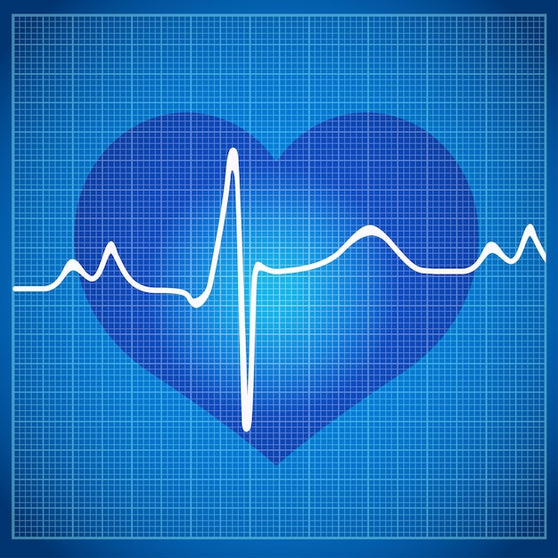 Cardiogramme De Coeur Sain Sur Le Fond Dans La Boîte à L'ecg