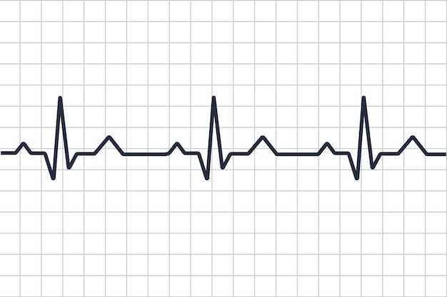 Cardiogramme Des Maladies Cardiaques. Ligne De Battement De Coeur. Cardiogramme. électrocardiogramme. Moniteur De Pouls Avec Signal