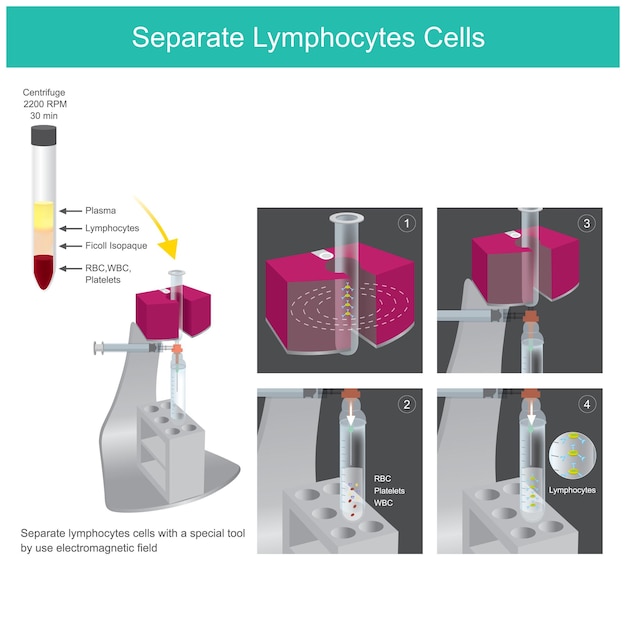 Vecteur cellules lymphocytaires séparées échantillon d'illustration pour l'utilisation d'un laboratoire médical par un officier expliquant un outil spécial pour séparer les cellules lymphocytaires du sang prélevéxa