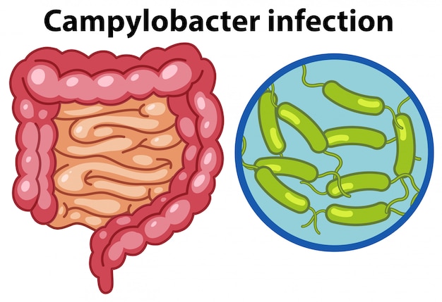 Cellules magnifiées de l'infection campylobacteri