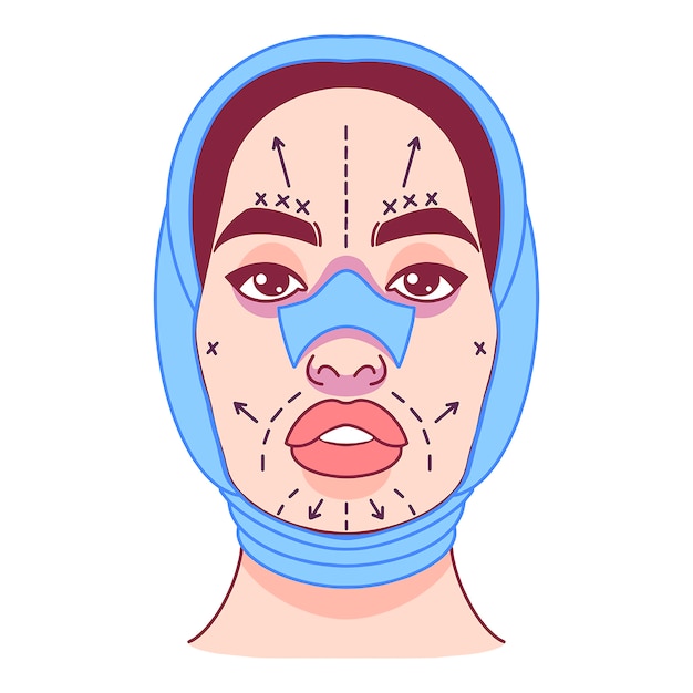 Vecteur chirurgie plastique, changement d’aspect, ligne d’incisions sur le visage féminin. illustration vectorielle