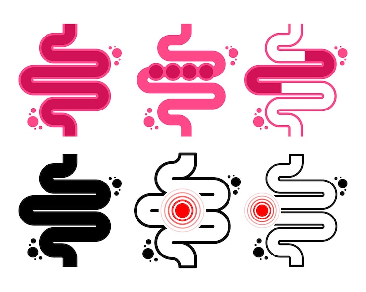Vecteur colite estomac constipation intestinale vecteur abdominal et ballonnement gastro-entérologie pour la santé médicale