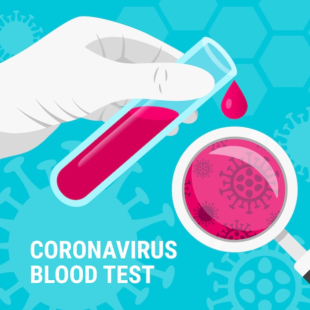 Concept Médical De Test Sanguin De Coronavirus. Tube à Essai En Verre Plat, Flacon Dans La Main Du Médecin, Goutte De Sang, Loupe Et Texte. Analyses Du Virus Corona 2019-ncov. Illustration