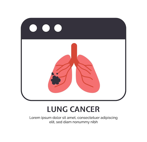 Vecteur concept de type de vecteur du cancer pulmonaire