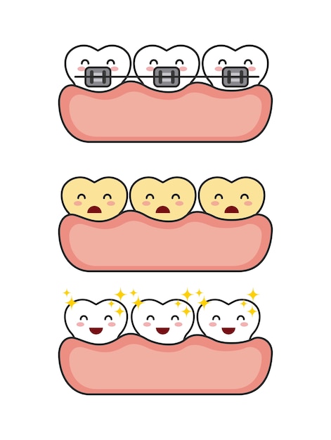 Vecteur conception d'hygiène dentaire