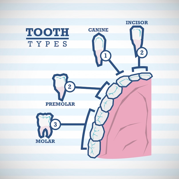 Conception de soins dentaires