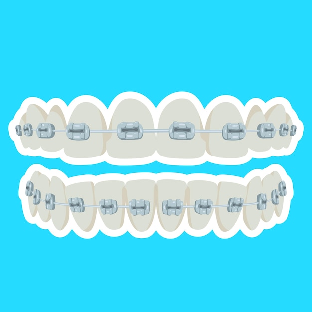 Des dents lisses et propres avec des appareils orthopédiques Des dents saines