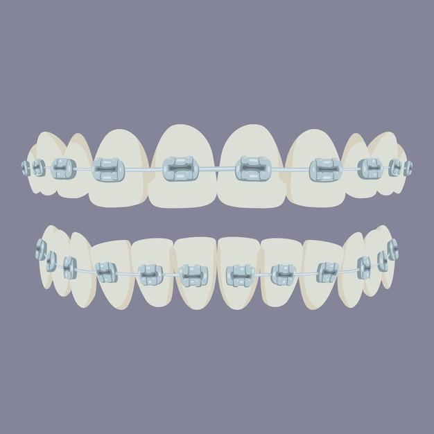 Dents Propres Et Lisses Avec Des Accolades Dents Saines