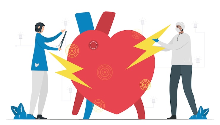 Vecteur diagnostic, analyse et traitement des maladies cardiaques telles que la fibrillation auriculaire. la fa est un type courant de rythme cardiaque irrégulier. les signaux électriques dans l'oreillette provoquent un battement rapide et irrégulier de l'oreillette.