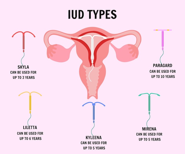 Vecteur dispositifs intra-utérins de type iud en vecteur