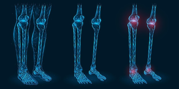 Vecteur douleur, blessure ou inflammation dans les genoux et les chevilles illustration polygonale. modèle low poly des articulations malades du genou et de la cheville.