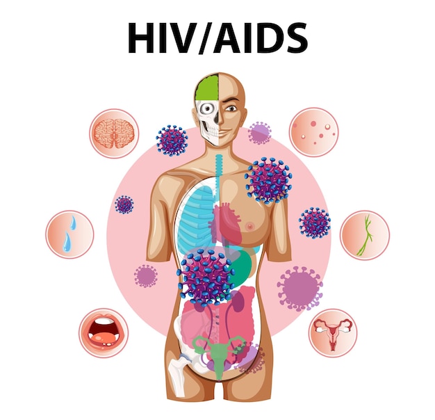 Vecteur effets du virus du vih/sida sur le système immunitaire et le corps