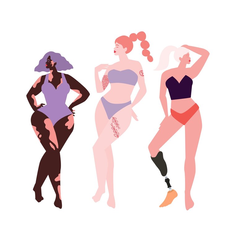 Vecteur ensemble féministe de femmes. ensemble de belles dames de la diversité sur fond blanc. pose pour une fille positive au corps. aime ton corps. femmes avec vitiligo, surpoids, jambes prothétiques, vergetures, cyllulite.