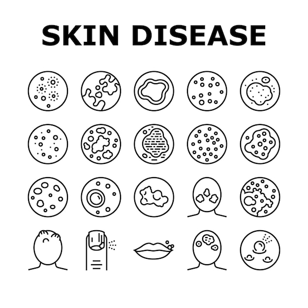 Vecteur ensemble d'icônes de collection de symptômes de maladie de la peau