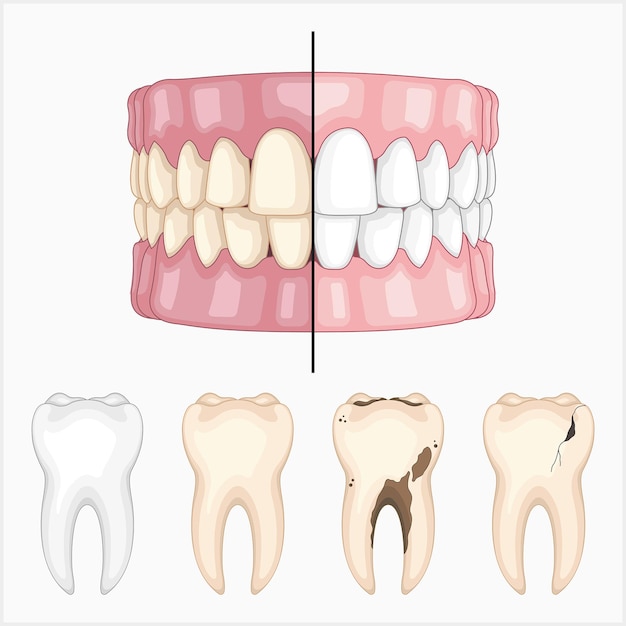 Ensemble D'illustrations Vectorielles Dentaires