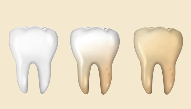 Ensemble De Maquette De Dents