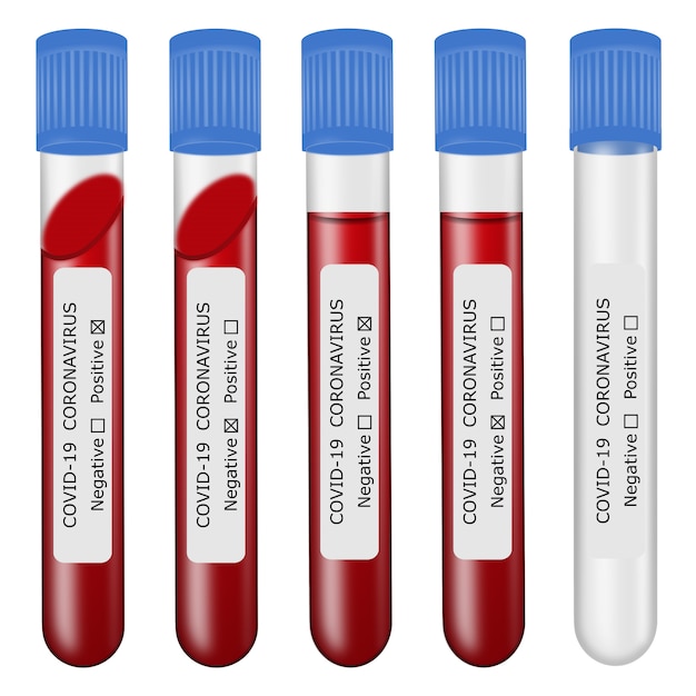 Vecteur ensemble de tests sanguins de coronavirus isolés. tubes à essai pleins et vides avec des étiquettes. tests positifs et négatifs