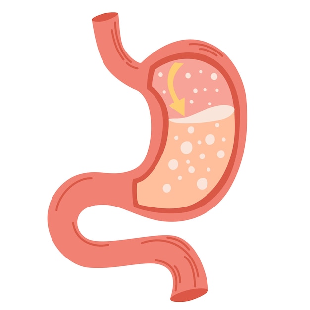 Estomac Humain Concept De Maladie De Reflux Gastro-oesophagien Concept D'estomac Malsain Maladie De Brûlures D'estomac Malaise Douleur Illustration Vectorielle Plane Isolée Sur Blanc