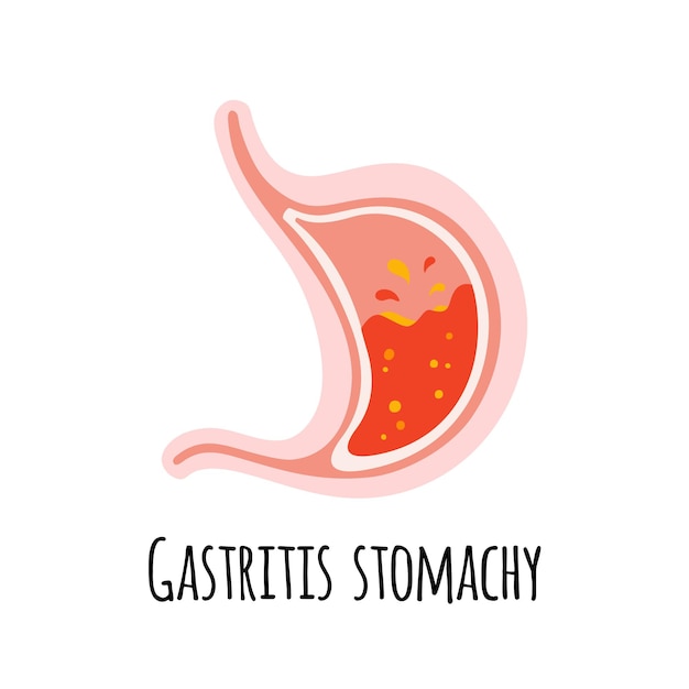 L'estomac d'une personne souffrant de gastrite Gastro-entérologie Illustration vectorielle dans un appartement