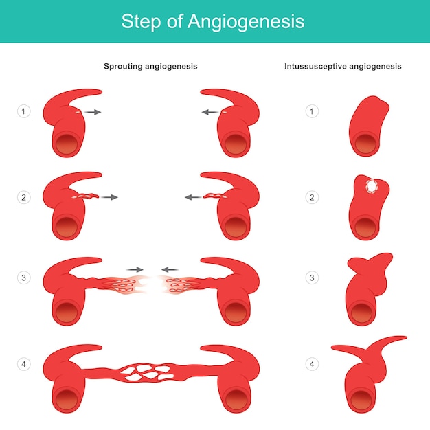 Vecteur Étape de l'angiogenèse apprentissage médical sur le processus de formation de l'artère et du capillaire dans le corps humain illustrationxa