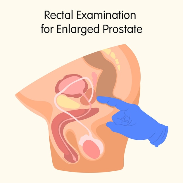 Examen De La Prostate Au Doigt En Urologie