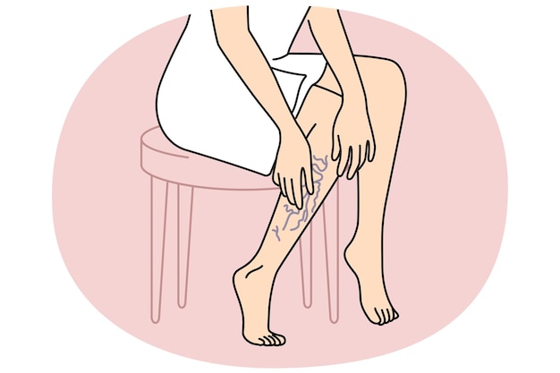 Vecteur une femme touchant des jambes avec des varices