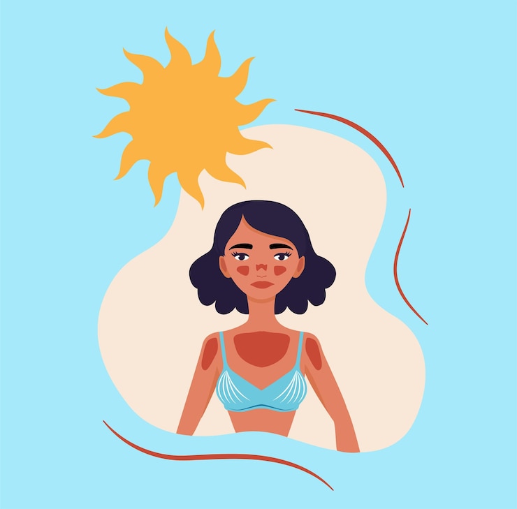Vecteur une fille triste avec des coups de soleil sur sa peau un été brillant illustration 2d