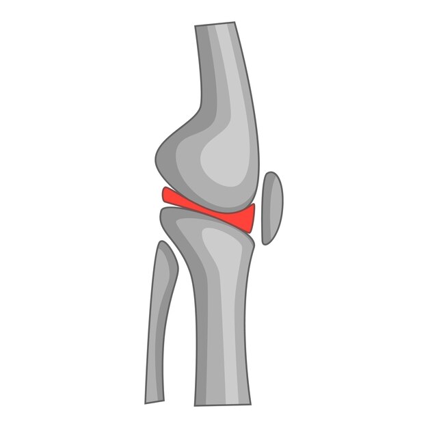 Vecteur icône de chirurgie d'arthroplastie totale du genou illustration de dessin animé de l'icône de vecteur d'arthroplastie totale du genou pour le web