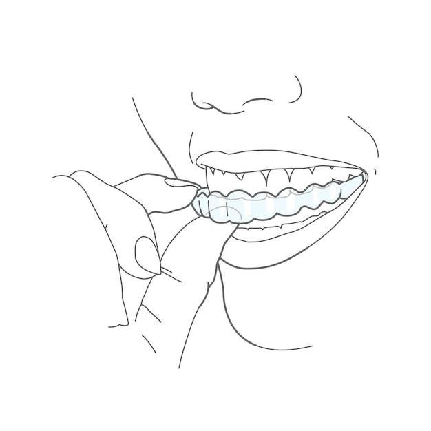 Vecteur icône invisalign