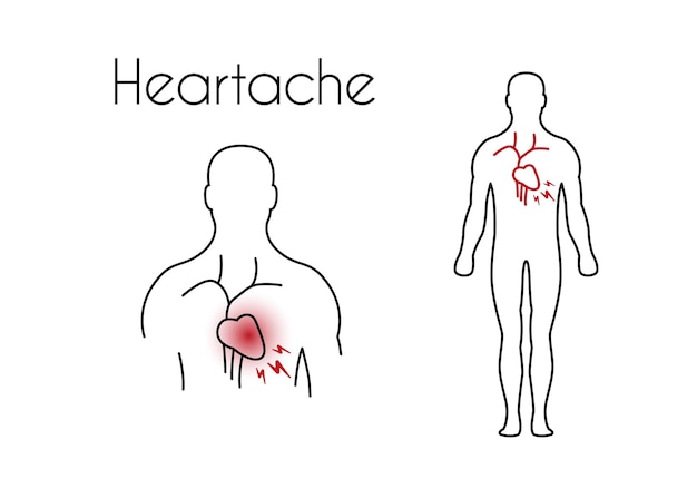 Vecteur icône linéaire de chagrin d'amour de vecteur de jeune homme