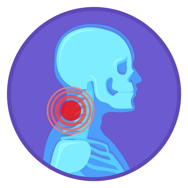 Vecteur icône ronde de douleur au cou anatomie osseuse humaine