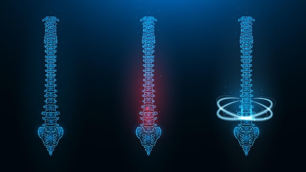 Illustration d'une colonne vertébrale en bonne santé et en convalescence
