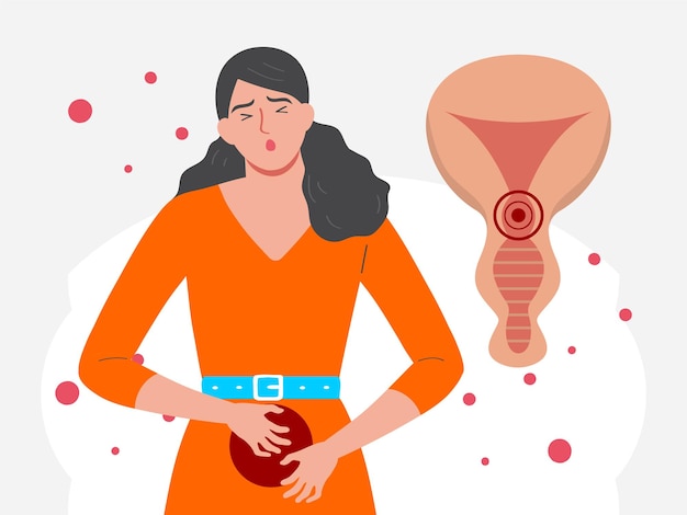 Illustration conceptuelle du cancer vulvaire élégante et belle