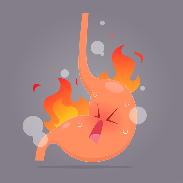 Illustration Du Reflux Acide Ou Des Brûlures D'estomac