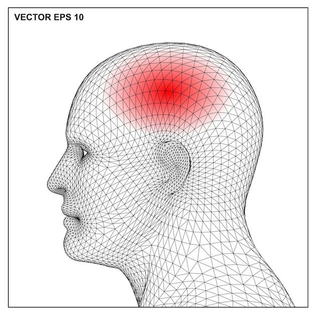 Vecteur illustration médicale montrant une inflammation douloureuse