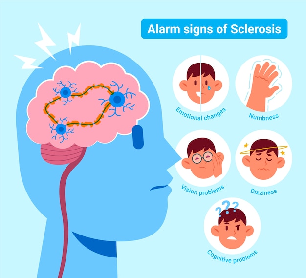 Vecteur illustration de la sclérose en plaques design plat dessiné à la main