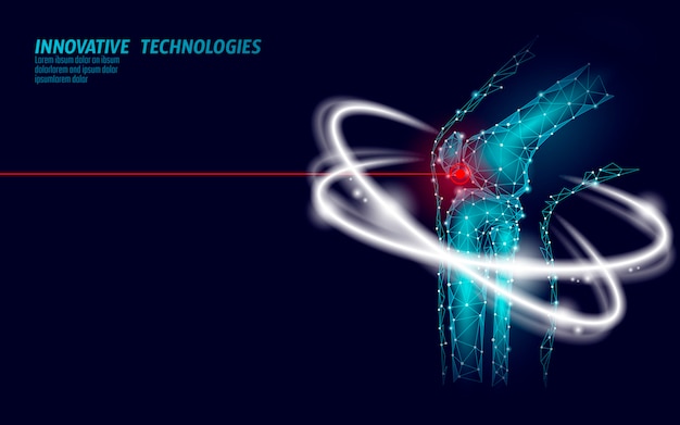 Vecteur illustration vectorielle de l'articulation du genou humain modèle 3d. futur design low poly