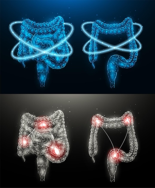 Illustration vectorielle polygonale d'un intestin humain enflammé et récupération de la fonction intestinale