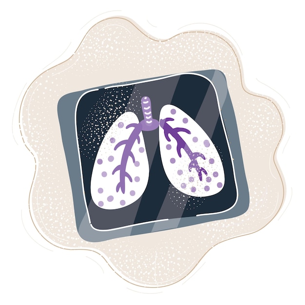 Illustration Vectorielle De Radiographie De La Poitrine