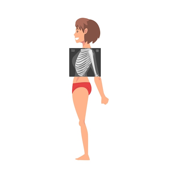 Vecteur illustration vectorielle de la radiographie thoracique féminine concept de procédure radiographique