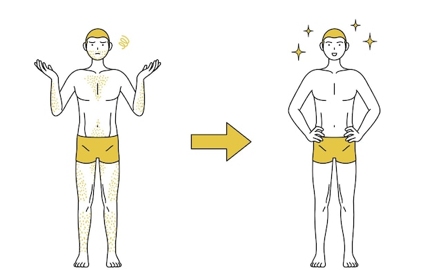 Image d'une épilation médicale avant et après d'un homme aux poils épais qui devient plus confiant après l'épilation