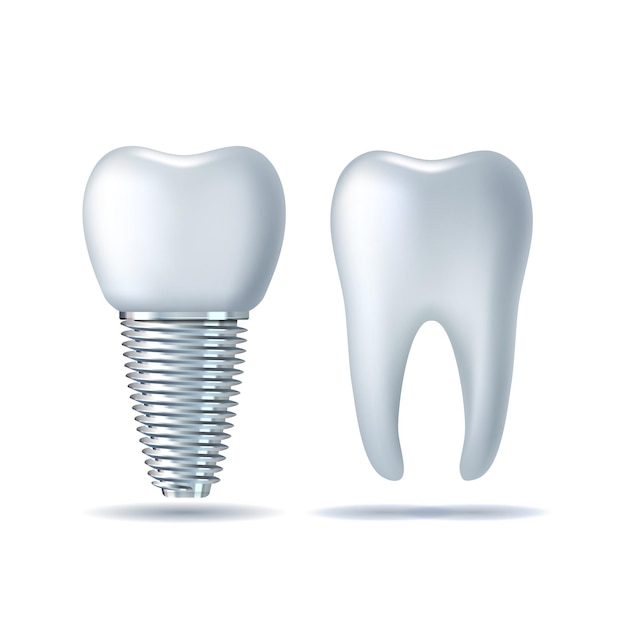 Vecteur image vectorielle 3d réaliste dent blanche et icône de prothèse dentaire implant dentaire gros plan isolé sur blanc